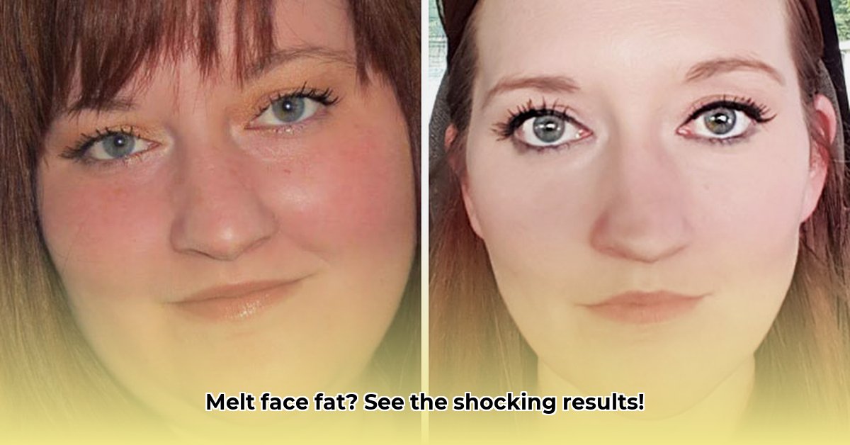 face-fat-before-and-after-weight-loss